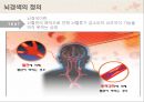 뇌경색의 치료와 간호 ppt 3페이지