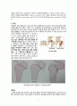 대퇴골 경부 골절 케이스 fracture of neck of femur, part unspecified, closed 간호과정 4페이지