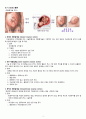 여성간호Case study  제왕절개 시나리오 간호과정 4페이지