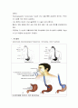 Esophagogastric Tamponade Tube(식도정맥류 출혈 풍선압박술) 간호 3페이지