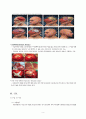 A+ SDH 경막하 출혈 케이스 스터디 8페이지