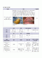 성인간호학케이스 기흉(Pneumothorax) - 통증, 비효과적 호흡양상, 감염위험성 9페이지