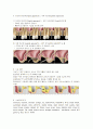 상악동 거상술 (Maxillary Sinus Lifting)의 정의, 적응증, 수술과정, 수술기구, 주의사항 2페이지
