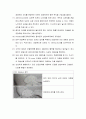 말초삽관중심도관 간호(peripherally inserted central catheter, PICC) 8페이지