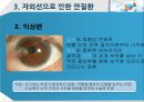 건강한 눈 관리법 6페이지