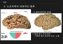 노인치매피피티완성본 11페이지
