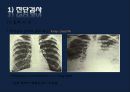 폐렴 / 폐렴 ppt / pneumonia 28페이지