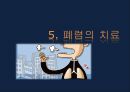 폐렴 / 폐렴 ppt / pneumonia 32페이지