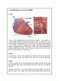 심근경색 / myocardial infarction / 순환기 내과 컨퍼런스 11페이지