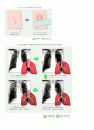 페질환 10페이지