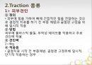 견인치료(traction) PPT 3페이지