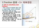견인치료(traction) PPT 8페이지