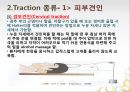견인치료(traction) PPT 9페이지