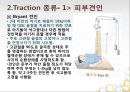 견인치료(traction) PPT 10페이지
