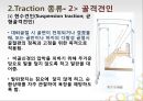 견인치료(traction) PPT 13페이지