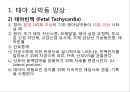 태아심박동 PPT 2페이지