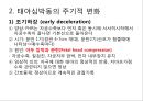 태아심박동 PPT 4페이지