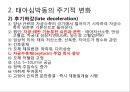 태아심박동 PPT 5페이지