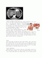 간암(Liver tumor) 문헌고찰 4페이지