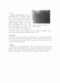 간암(Liver tumor) 문헌고찰 6페이지