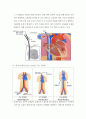 체외막 산소공급과 심실보조장치(Extracorporeal Membrane Oxygenation and Ventricular Assist Device) 4페이지