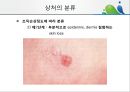 [상처관리-욕창, 수] 상처관리-욕창,  수술창상,  화상 10페이지