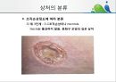 [상처관리-욕창, 수] 상처관리-욕창,  수술창상,  화상 11페이지