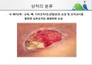 [상처관리-욕창, 수] 상처관리-욕창,  수술창상,  화상 12페이지
