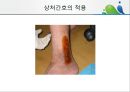 [상처관리-욕창, 수] 상처관리-욕창,  수술창상,  화상 27페이지