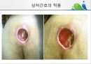 [상처관리-욕창, 수] 상처관리-욕창,  수술창상,  화상 32페이지