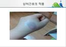 [상처관리-욕창, 수] 상처관리-욕창,  수술창상,  화상 33페이지