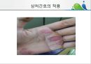 [상처관리-욕창, 수] 상처관리-욕창,  수술창상,  화상 36페이지