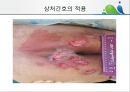 [상처관리-욕창, 수] 상처관리-욕창,  수술창상,  화상 37페이지