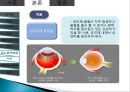 망막장애 대상자 병태생리, 간호 20페이지