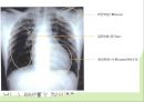소변검사, 혈액검사, 흉부 X-ray 23페이지