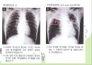 소변검사, 혈액검사, 흉부 X-ray 28페이지