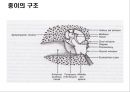 청각기관의 구조 및 장애발생 원인, 분류 9페이지