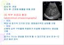 위장관계 진단 검사 11페이지