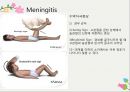 뇌수막염에 관한 ppt 자료입니다 간호에 대해서도 담았습니다 7페이지
