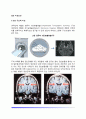 뇌의 이상요인(뇌의 구조적 이상, 신경전달물질의 이상, 기능적 이상, 심경심리검사에서 나타난 이상) 2페이지