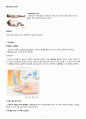 세균성 수막염 case study 5페이지