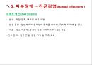 아동간호학 피부감각계 ppt및 관련논문 요약,case study 9페이지