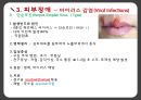 아동간호학 피부감각계 ppt및 관련논문 요약,case study 12페이지