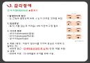 아동간호학 피부감각계 ppt및 관련논문 요약,case study 21페이지