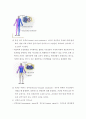 척추외상, 척추손상 간호 9페이지