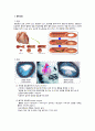 성인간호학 협심증(angina pectoris) 케이스 스터디 A+++++ 4페이지