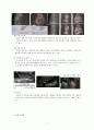 초음파 검사(심장, 뇌, 갑상선 외 6가지)에 대해 모두 공부할 수 있는 자료! 만점자부하는 자료! A+보장하는 자료! 6페이지
