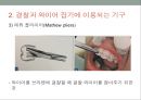 치과교정학 - 교정치료에 사용하는 기구와 취급방법 16페이지