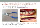 치과교정학 - 교정치료에 사용하는 기구와 취급방법 21페이지