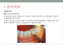 치과교정학 - 교정치료에 사용하는 기구와 취급방법 40페이지